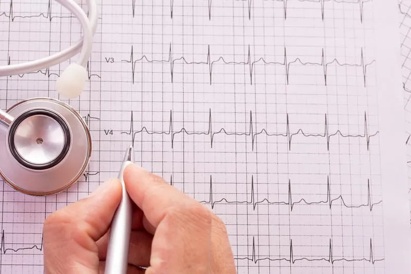 Preço de eletrocardiograma